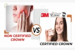 Chinese dental crowns