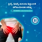 Piles treatment in homeopathy