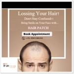 Hair Patch Clinic in Delhi