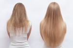 Non-Surgical Hair Transplant