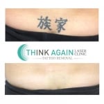 Think Again Laser Clinic - Auckland