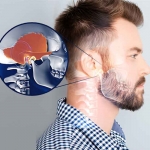 TMJ Dysfunction Treatment in Surrey