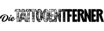 Dietattooentferner - Removing Tattoos Safely and Effectively