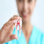 Root Canal Treatment at SKN Cosmetics