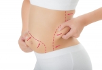 Royal Clinic Saudi Arabia - Laser Liposuction Treatments