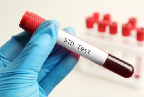 Advanced STD Testing & Treatment Clinic