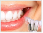 Zirkonyum implant ve estetik diÅ hekimliıi web sitesi