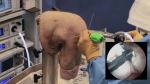 Arthroscopy Surgeon in Delhi | Arthroscopy Surgeon in NCR |