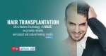 Hair Tranplantation in bangalore