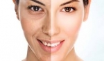 Best Anti Ageing Clinic in Delhi