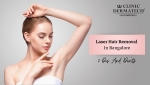 Laser Hair Removal In Bangalore: 3 Dos And Donts