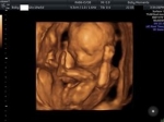 How much are 4d baby scan
