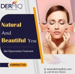 Laser Pigmentation Treatment | Pigmentation Removal Near Me