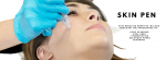 Advanced Skin Treatments at Ultimate Indulgence
