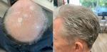 Reasons to own a silver gray human hair wig