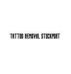 TATTOO REMOVAL STOCKPORT