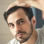 Hair Transplant In Islamabad