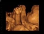 3D BabyVision Mississauga