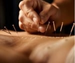 Cambridge Acupuncture Association