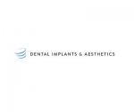 Dental Implant & Aesthetics