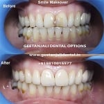 Geetanjali Dental Options