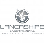 Lancashire Laser Removal