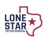 Lone Star Tattoo Removal
