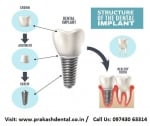 Prakash Dental &amp; maxillofacial Clinic