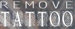 RemoveTattoo
