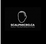 SCALPMICRO Scalp Micropigmentation Calgary
