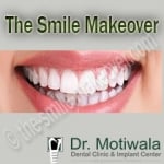 The Smile Makeover