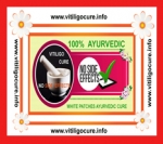 vitiligo cure center